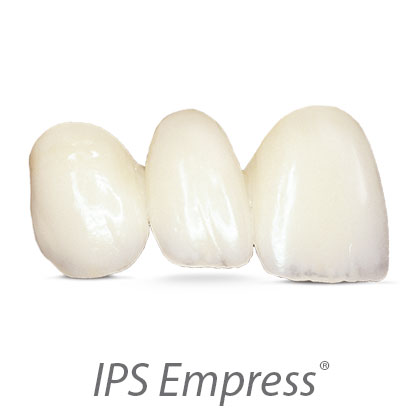 IPS-Empress