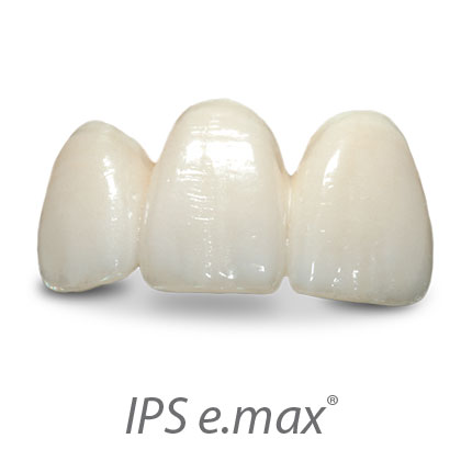 IPS-e.max