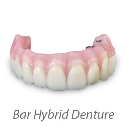 Fixed Hybrid Denture
