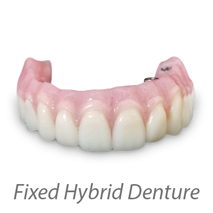 Fixed Hybrid Denture